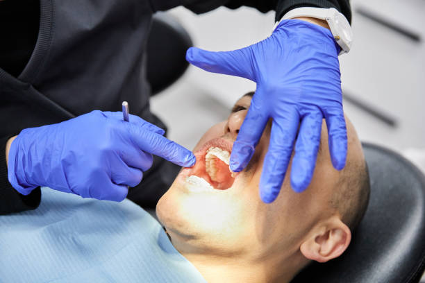 Best Emergency Tooth Extraction in Pine Level, NC