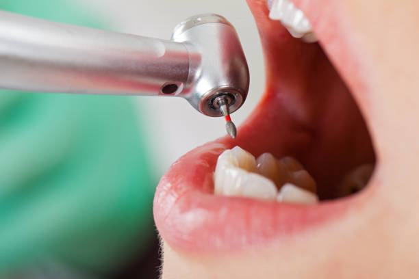 Best Emergency Dental Surgery in Pine Level, NC
